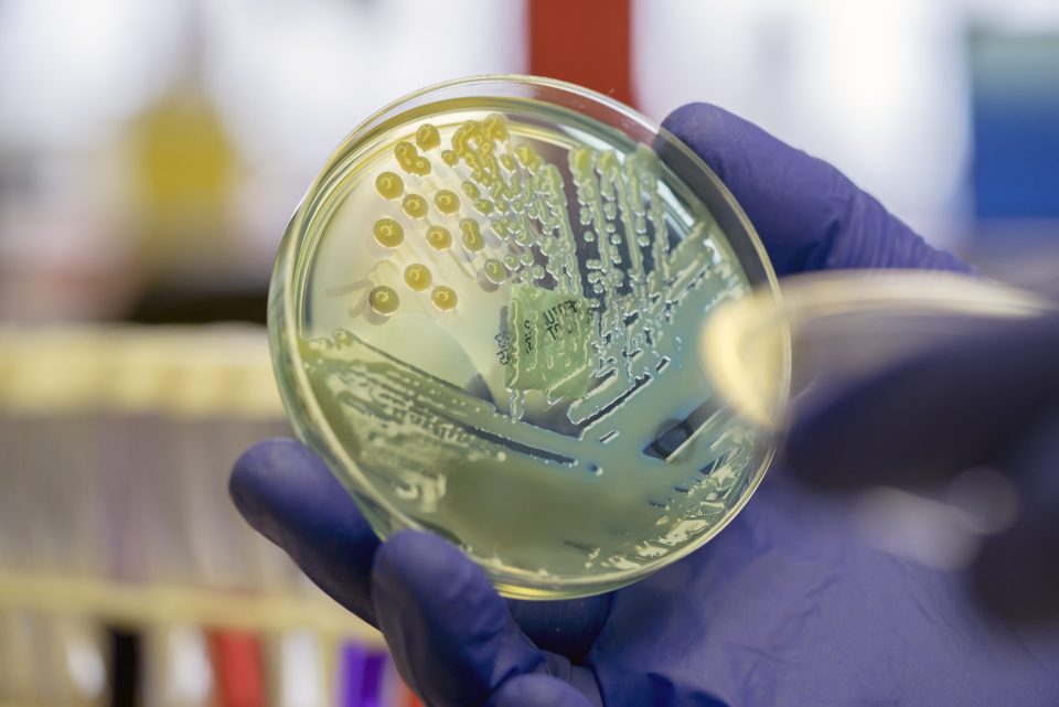 微生物学家在 CLED 琼脂平板上检查多重耐药大肠菌（肺炎克雷伯菌）细菌。